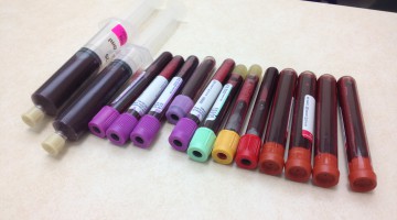 Que Exámenes de Laboratorio se Recomiendan para Alguien que Usa Esteroides?